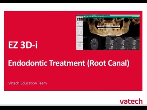 Endo Treatment (Root Fracture Case)
